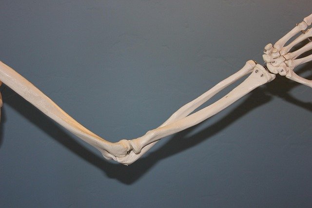 skeleton, elbow, anatomy, human, body, bone, joint, arthritis, blue body, blue human, elbow, elbow, elbow, elbow, elbow, arthritis, arthritis